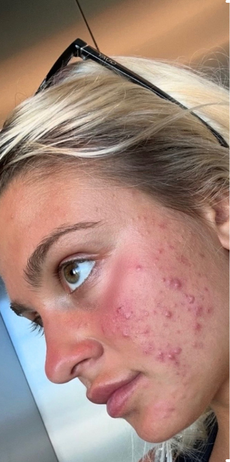 Before: a customer’s face.