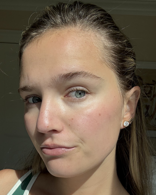 Skin At Peace skin transformation 2 — after