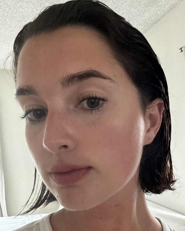 Skin At Peace skin transformation 3 — after