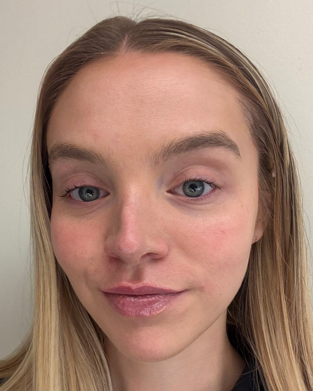 Skin At Peace skin transformation 5 — after