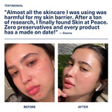 Customer testimonial from Gianna with a before-and-after: red, irritated skin on the left and clearer skin on the right.