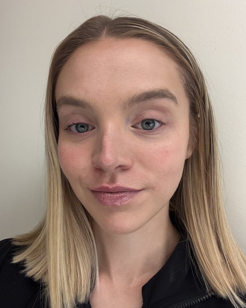 After: the same customer’s face.