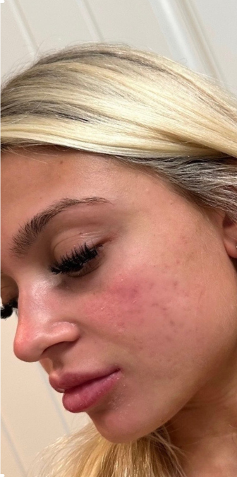 After: the same customer’s face.